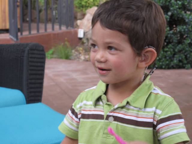 Implante coclear en niños
